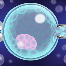 Pre-Implantation Genetic Diagnosis