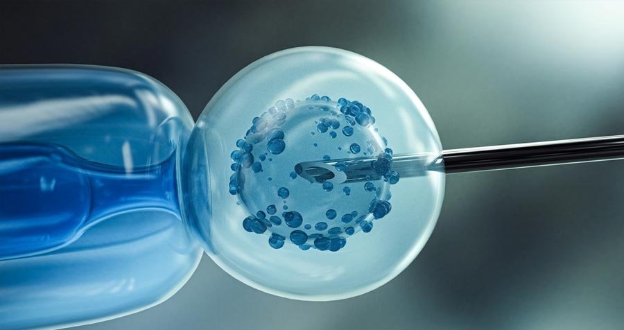 Frozen Embryo Transfer